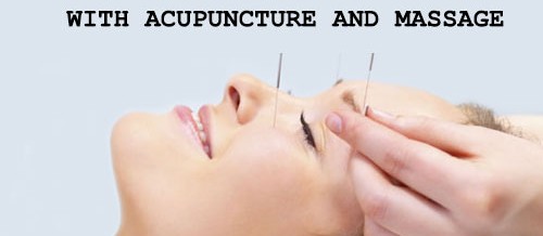 FACIAL LIFTING