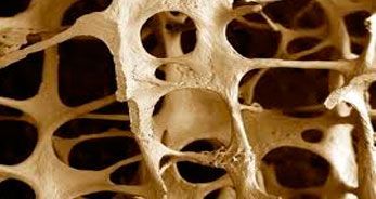 osteo